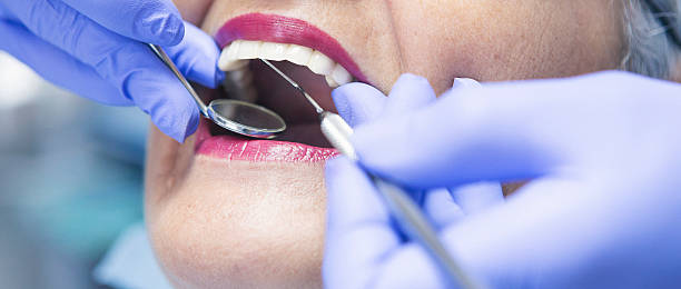Best Chipped Tooth Repair Near Me  in Santa Ana Pueblo, NM